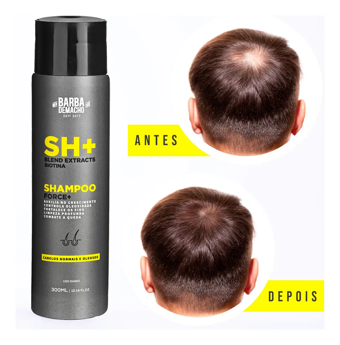 Shampoo Sh Force + Zero Queda E Oleosidade Masculino 300ml