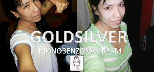 Crema Blanqueadora Permanente (monobenzona 50 Gr Al 40%)