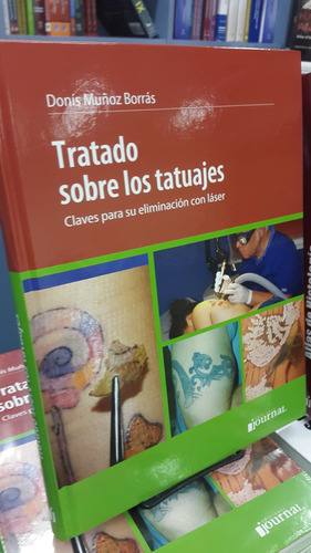 Tratado Sobre Los Tatuajes Eliminar Con Láser