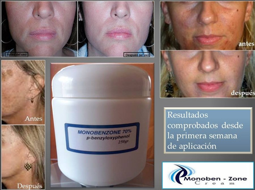 Crema Blanqueadora Permanente (monobenzona 50 Gr Al 40%)