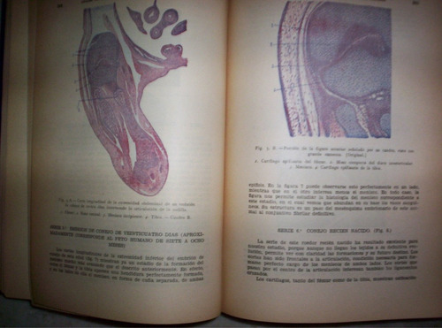 Anales De Patologia Quirurgica Tomo 3 Compilacion Piulachs