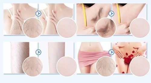 Pilaten Hair Removal Crema Depiladora 10gr. Original