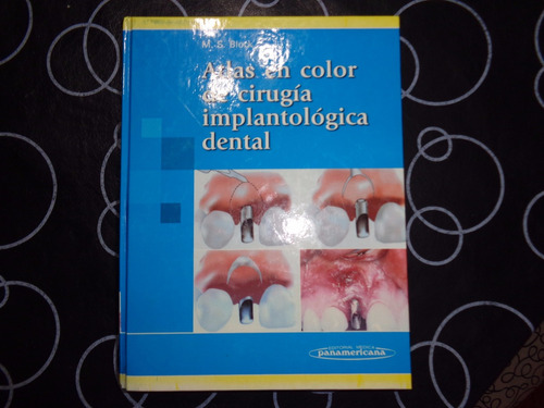 Atlas En Color De Cirugia Implantologica Dental, M. S. Block