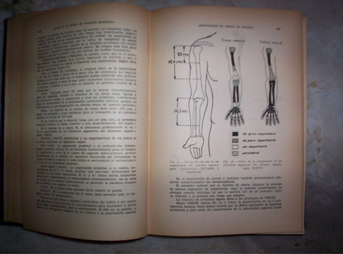 Anales De Patologia Quirurgica Tomo 3 Compilacion Piulachs