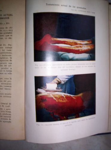 Anales De Patologia Quirurgica Tomo 3 Compilacion Piulachs