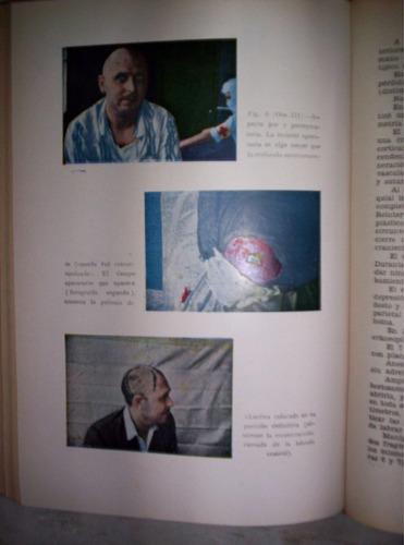 Anales De Patologia Quirurgica Tomo 3 Compilacion Piulachs