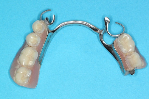 Dentista - Prótesis Dentales - Implantes - Extracciones
