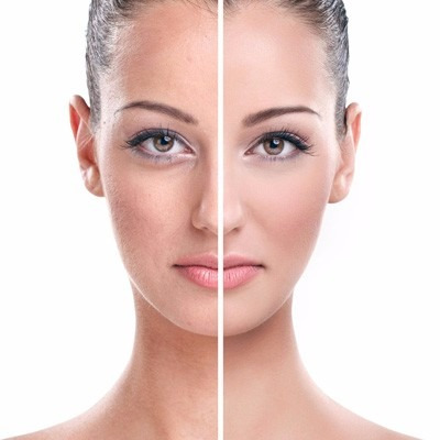 Imagen 4 de 6 de Hydrapore Loción Hidratante Con Acido Hialuronico Lidherma