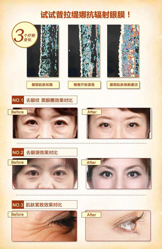 Imagen 5 de 5 de Pilaten Colageno Ojos Original 25 Pz Distribuidor Autorizado