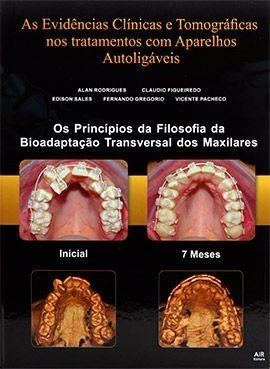 As Evidencias Clínicas E Tomográficas Nos Tratamentos Com Ap