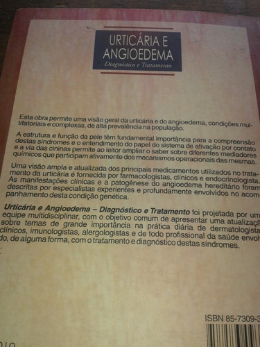 Urticária E Angiodema - Diagnóstico E Tratamento