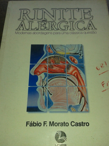 Rinite Alérgica