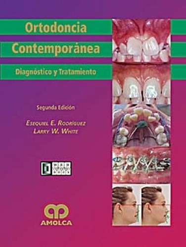 Ortodoncia Contemporánea, Diagnóstico Y Tratamiento / Amolca