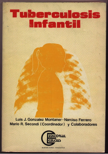Tuberculosis Infantil. Gonzalez Montaner, Ferrero, Secondi