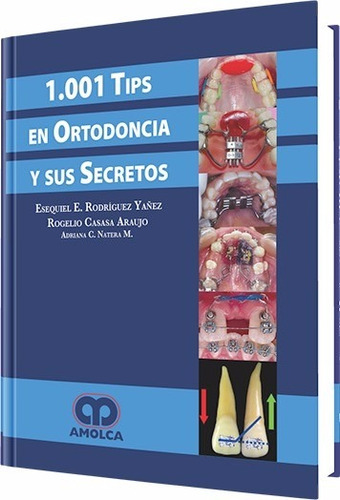 1001 Tips En Ortodoncia Y Sus Secretos - Rodriguez / Amolca