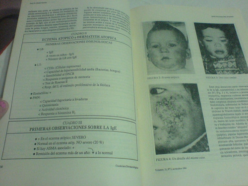 Cuadernos Dermatologicos Volumen Ii (noviembre 1994) N° 2-