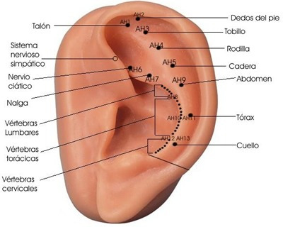 Semillas De Vaccaria X 600 Auriculoterapia Al Mejor Precio!!