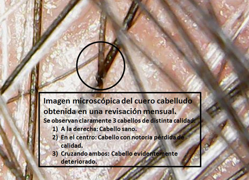Imagen 7 de 7 de Tratamiento Masajes Capilares Qabello Caída De Cabello?no!
