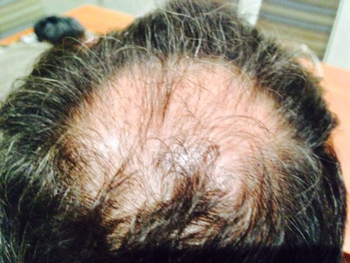 Shampoo Y Revitalizador Seber Para Problemas Capilares.
