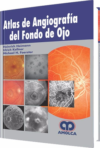 Atlas De Angiografía Del Fondo De Ojo / Heimann / Amolca