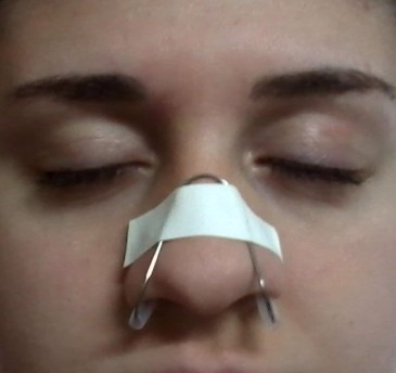 Nasalopen - Dilatador Nasal Inox C/ 2 (dois)earclean Grátis