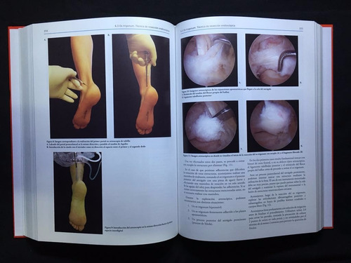 Artroscopia De Tobillo - Bases Y Fundamentos - Jorge Batista