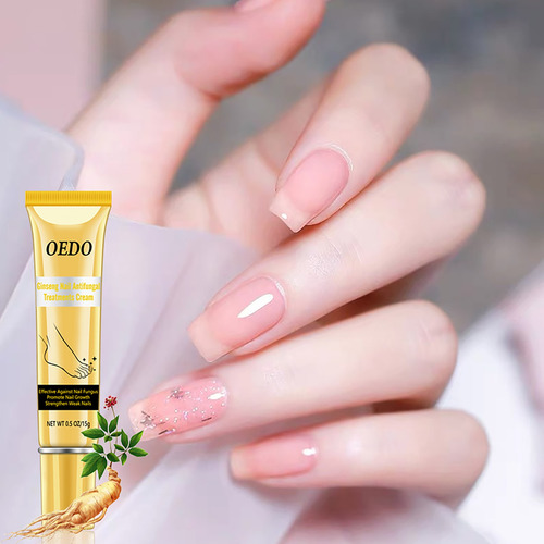 Crema Para Hongos En Las Uñas, Cuidado De Los Pies, Antimicó