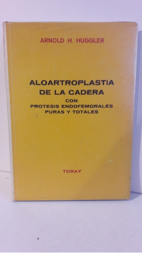 Aloartroplastia De La Cadera Con Prótesis Endofemorales