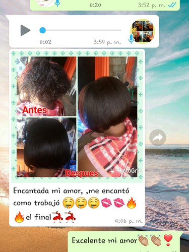 Imagen 2 de 6 de Cirugía Capilar El Mejor Tratamiento Para Tu Cabello