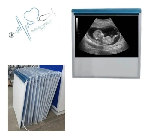 Imagen 8 de 9 de Negatoscopio Led Ultra Slim 60x60cm .7 Milimetros De Grueso