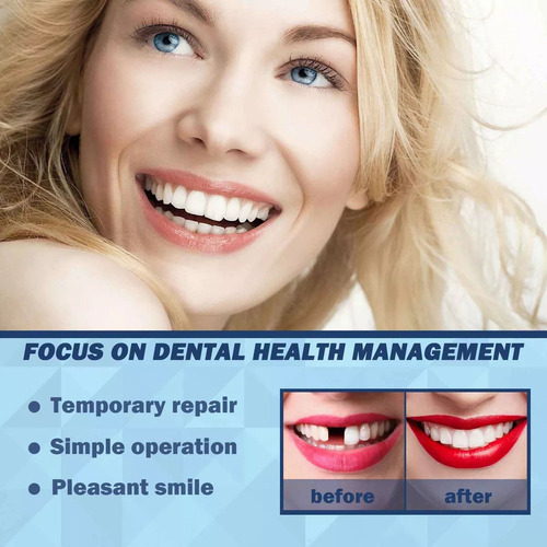 Caries Y Costura De Dientes Rotos Con Resina Plástica De Gut