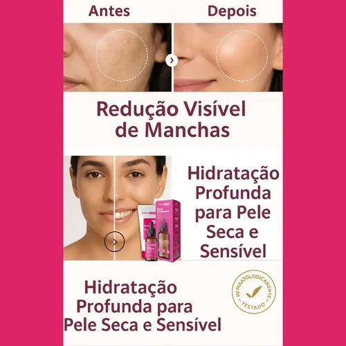 Kit Skincare Rosa Mosqueta+sérum Clareador Dermachem 4 Itens