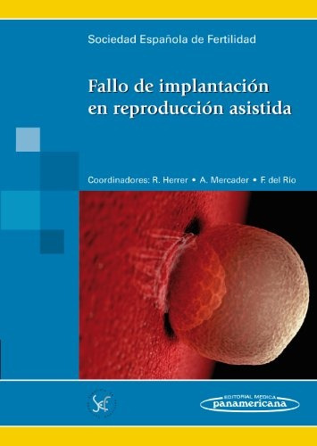 50* Fallo De Implantacion En Reproduccion Asistida - Socieda