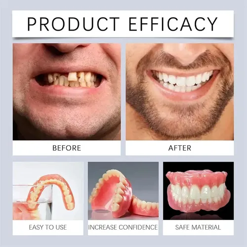 Nuevas Dentaduras Postizas Unisex con Acabado Brillante, Juego Superior
