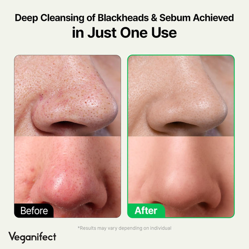 Aceite De Limpieza Profunda Lha Maquillaje Removedor De Punt