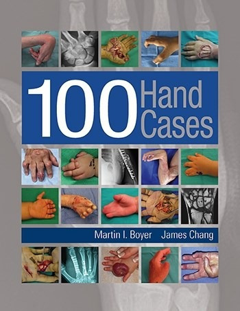 100 Hand Cases - Boyer, Martin I. (papel)