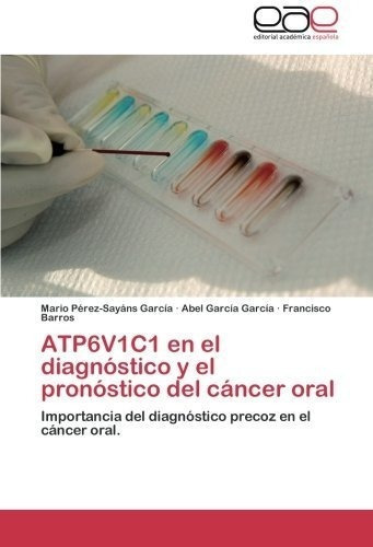 Atp6v1c1 En El Diagnostico Y El Pronostico Del Cancer Oral: