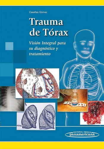 Libro Casallas:trauma De Torax - Casallas Gomez, Alvaro