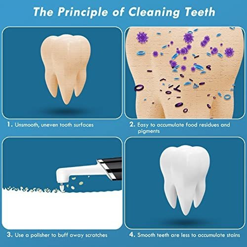 Pulidor De Dientes Pelzzle, Kit De Limpieza De Dientes Recar