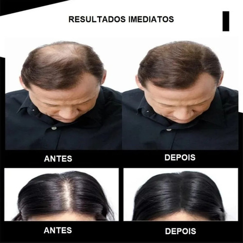 Kit Com 2 Fibra Capilar Pó De Queratina Natural Com 27,5g
