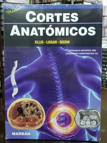 Cortes Anatómicos Ellis - Marban