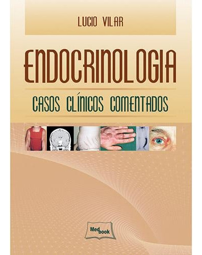 Endocrinologia-casos Clínicos Comentados