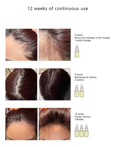 Aceite Esencial Original Hair Authentic Care Growth Ordinary