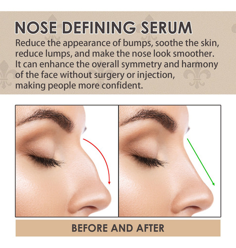 E 30 Ml Nasal Mejora La Forma Y Del Nasal 8031