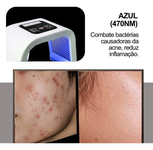 Cabine Cromoterapia Led 7 Cores Tratamento Terapia Facial Instrumento De Beleza De Espectro Colorido Remoção De Acne E Rejuvenescimento Da Pele Com Tecnologia De Fóton Mais Branco Para Sardas