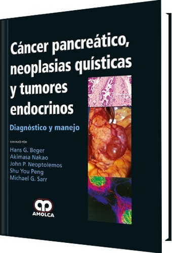 Cáncer Pancreático Neoplasias Quísticas Y Tumores Endocrinol