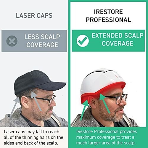 Irestore Sistema Profesional De Crecimiento Del Cabello Con