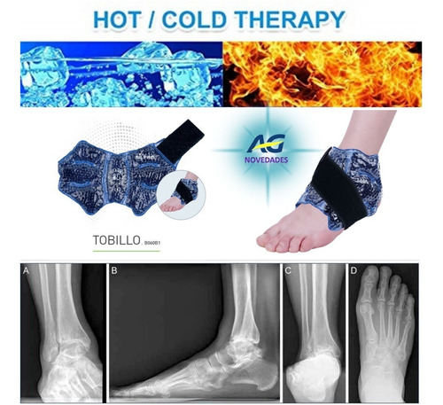Dolor De Tobillo Tobillera Terapia Gel Friocalor Agnovedades