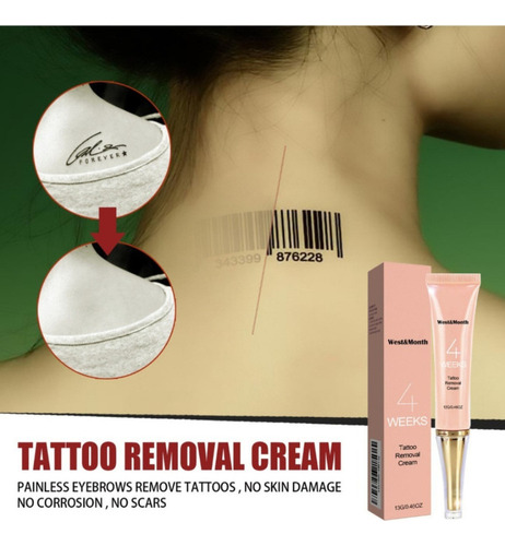 Crema De Eliminación Permanente De Tatuajes Crema Eliminador