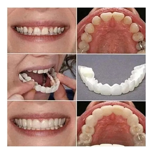 Carillas Silicona Dientes Postizos Sonrisa Superior/inferior